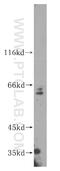 Poly(ADP-Ribose) Polymerase Family Member 6 antibody, 16945-1-AP, Proteintech Group, Western Blot image 