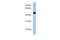 Solute carrier family 25 member 46 antibody, GTX46778, GeneTex, Western Blot image 