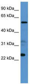 Copine Family Member 9 antibody, TA337825, Origene, Western Blot image 