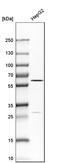 TGH antibody, HPA012023, Atlas Antibodies, Western Blot image 