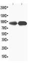 Transient Receptor Potential Cation Channel Subfamily V Member 1 antibody, PA1323, Boster Biological Technology, Western Blot image 