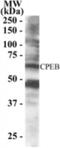Cytoplasmic Polyadenylation Element Binding Protein 1 antibody, NB100-1437, Novus Biologicals, Western Blot image 