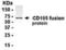 Endoglin antibody, XW-8105, ProSci, Western Blot image 