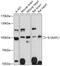 Interleukin 1 Receptor Accessory Protein Like 1 antibody, 19-052, ProSci, Western Blot image 