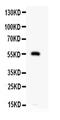 Matrix Metallopeptidase 12 antibody, RP1089, Boster Biological Technology, Western Blot image 