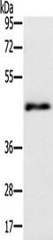 Twinfilin Actin Binding Protein 1 antibody, TA350305, Origene, Western Blot image 