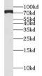 Metastasis Associated 1 Family Member 2 antibody, FNab05388, FineTest, Western Blot image 