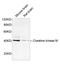 Creatine Kinase, M-Type antibody, LS-C203177, Lifespan Biosciences, Western Blot image 