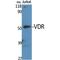 Vitamin D Receptor antibody, LS-C386640, Lifespan Biosciences, Western Blot image 