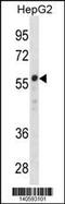 Zinc Finger Protein 276 antibody, 60-544, ProSci, Western Blot image 