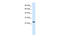 Charged Multivesicular Body Protein 3 antibody, 28-095, ProSci, Western Blot image 