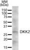 Dickkopf WNT Signaling Pathway Inhibitor 2 antibody, NB300-810, Novus Biologicals, Western Blot image 