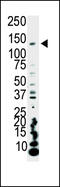 Phosphatidylinositol-4,5-Bisphosphate 3-Kinase Catalytic Subunit Alpha antibody, MBS9200737, MyBioSource, Western Blot image 