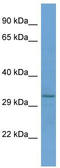 Ring Finger Protein 150 antibody, TA330452, Origene, Western Blot image 