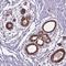 Interferon Regulatory Factor 6 antibody, NBP2-49383, Novus Biologicals, Immunohistochemistry frozen image 