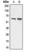 Apoptosis Antagonizing Transcription Factor antibody, LS-C353394, Lifespan Biosciences, Western Blot image 