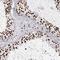 TRNA Methyltransferase 6 antibody, FNab09008, FineTest, Immunohistochemistry frozen image 