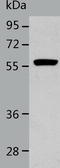 Aldehyde Dehydrogenase 1 Family Member A2 antibody, TA324162, Origene, Western Blot image 