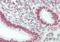 Erb-B2 Receptor Tyrosine Kinase 4 antibody, orb256521, Biorbyt, Immunohistochemistry paraffin image 
