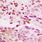 JunB Proto-Oncogene, AP-1 Transcription Factor Subunit antibody, LS-C356141, Lifespan Biosciences, Immunohistochemistry paraffin image 