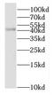 NAD(P) Dependent Steroid Dehydrogenase-Like antibody, FNab05864, FineTest, Western Blot image 