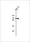 Interleukin 10 Receptor Subunit Alpha antibody, 63-634, ProSci, Western Blot image 