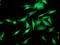 Leucine Rich Glioma Inactivated 1 antibody, orb150838, Biorbyt, Immunocytochemistry image 