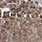 Ras-related protein Rab-7L1 antibody, NBP1-87173, Novus Biologicals, Immunohistochemistry paraffin image 