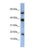 Ataxin 7 Like 1 antibody, NBP1-56311, Novus Biologicals, Western Blot image 