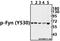 FYN Proto-Oncogene, Src Family Tyrosine Kinase antibody, A00684Y530, Boster Biological Technology, Western Blot image 
