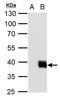 ISL LIM Homeobox 2 antibody, GTX129375, GeneTex, Western Blot image 