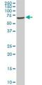 EPM2A Interacting Protein 1 antibody, H00009852-M01, Novus Biologicals, Western Blot image 