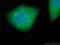 Keratin 34 antibody, 20449-1-AP, Proteintech Group, Immunofluorescence image 