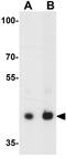 C-X-C Motif Chemokine Receptor 3 antibody, GTX31566, GeneTex, Western Blot image 