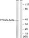 Ribosomal Protein S6 Kinase B2 antibody, LS-C118316, Lifespan Biosciences, Western Blot image 