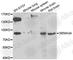 Semaphorin 3A antibody, A5700, ABclonal Technology, Western Blot image 