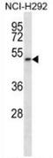 Phosphatidylinositol Glycan Anchor Biosynthesis Class T antibody, AP53300PU-N, Origene, Western Blot image 