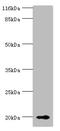 Retinol Binding Protein 5 antibody, A60562-100, Epigentek, Western Blot image 