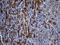 Transforming Growth Factor Beta Induced antibody, LS-C790598, Lifespan Biosciences, Immunohistochemistry paraffin image 