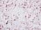 IKAROS Family Zinc Finger 2 antibody, NBP2-16802, Novus Biologicals, Immunohistochemistry frozen image 