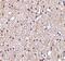 BR Serine/Threonine Kinase 2 antibody, PA5-20358, Invitrogen Antibodies, Immunohistochemistry paraffin image 