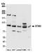 Stromal Interaction Molecule 2 antibody, A304-430A, Bethyl Labs, Western Blot image 