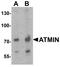 ATM Interactor antibody, A06542, Boster Biological Technology, Western Blot image 