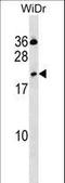 C-Type Lectin Domain Family 2 Member D antibody, LS-C159365, Lifespan Biosciences, Western Blot image 