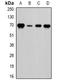 Leukotriene A4 Hydrolase antibody, orb340840, Biorbyt, Western Blot image 