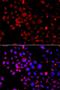 Snail Family Transcriptional Repressor 2 antibody, orb48975, Biorbyt, Immunocytochemistry image 