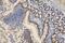 SWI/SNF Related, Matrix Associated, Actin Dependent Regulator Of Chromatin, Subfamily A, Member 4 antibody, M00223-1, Boster Biological Technology, Immunohistochemistry paraffin image 