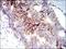 Insulin Like Growth Factor 1 Receptor antibody, NB110-87052, Novus Biologicals, Immunohistochemistry paraffin image 