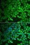 Arachidonate 15-Lipoxygenase Type B antibody, orb247637, Biorbyt, Immunofluorescence image 