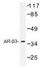 Adrenoceptor Beta 3 antibody, AP01420PU-N, Origene, Western Blot image 